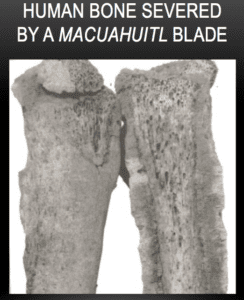 Human Bone Severed by a Macuahuitl Blade